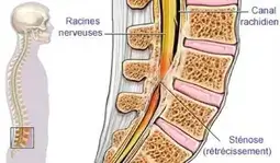 La colonne vertébrale (ou rachis)