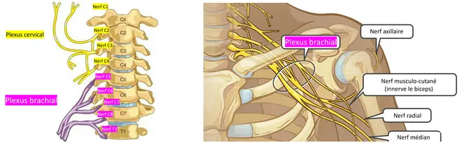névralgie cervico-brachiale