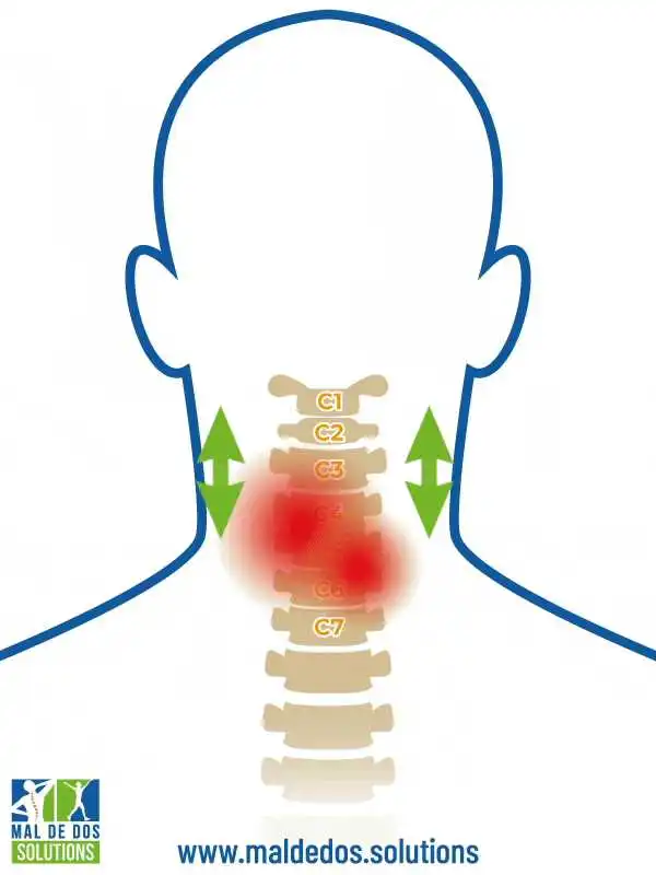 efficacité collier cervical