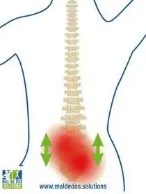 Comment traiter et soulager la sciatique d’origine compressive