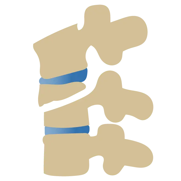 Comprendre la douleur de fracture de vertèbre